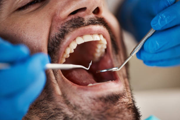 Best Emergency Denture Repair in Maysville, GA